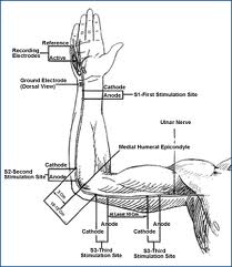 Neurophysiology Services